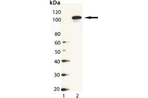 Western Blot Analysis of HSP104 (yeast), pAb : Lane 1: MW Marker, Lane 2: Yeast Cell Lysate (HSP104 Antikörper  (C-Term))