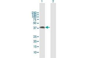 Western Blot analysis of NOV expression in transfected 293T cell line by NOV MaxPab polyclonal antibody. (NOV Antikörper  (AA 1-357))