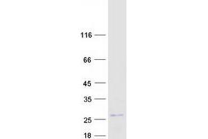 Validation with Western Blot (MCTS1 Protein (Transcript Variant 1) (Myc-DYKDDDDK Tag))