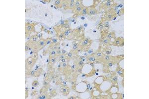 Immunohistochemistry (Paraffin-embedded Sections) (IHC (p)) image for anti-NADH Dehydrogenase (Ubiquinone) 1 alpha Subcomplex, 7, 14.5kDa (NDUFA7) (AA 1-113) antibody (ABIN6144465)
