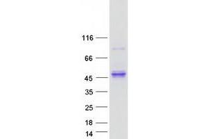 Validation with Western Blot (Kallikrein 11 Protein (KLK11) (Transcript Variant 2) (Myc-DYKDDDDK Tag))