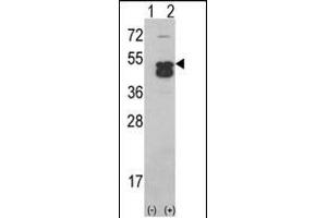 Western blot analysis of CK1D (arrow) using CK1D (CK1 delta)Antibody (C-term) (ABIN391307 and ABIN2841342). (CAMK1D Antikörper  (C-Term))