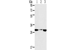 Western Blotting (WB) image for anti-Succinate Dehydrogenase Complex, Subunit B, Iron Sulfur (Ip) (SDHB) antibody (ABIN2433756) (SDHB Antikörper)
