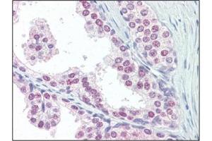 Immunohistochemistry: UBA52 antibody staining of Formalin-Fixed, Paraffin-Embedded Human Prostate followed by biotinylated goat anti-rabbit IgG secondary antibody, alkaline phosphatase-streptavidin and chromogen.