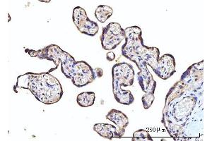 IHC analysis of RPS5 using anti-RPS5 antibody (ABIN7599076). (RPS5 Antikörper  (AA 1-204))