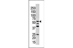 Image no. 1 for anti-Inositol-Trisphosphate 3-Kinase A (ITPKA) (N-Term) antibody (ABIN360690) (ITPKA Antikörper  (N-Term))