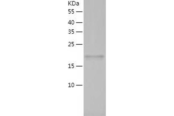 PPIH Protein (AA 2-177) (His tag)