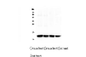 Western blot analysis of Cardiac FABP using anti-Cardiac FABP antibody .