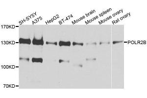 Western blot analysis of extracts of various cell lines, using POLR2B antibody. (POLR2B Antikörper  (AA 1-260))