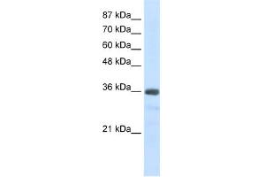 WB Suggested Anti-U1SNRNPBP Antibody Titration:  2. (SNRNP35 Antikörper  (N-Term))