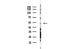 Western blot analysis of lysates from COLO205 cells(starvation 24h treatment), using RA Antibody at 1/1000 dilution.
