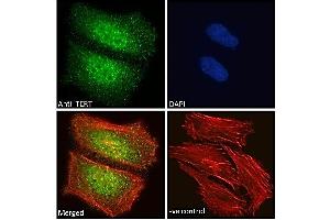 ABIN940568 Immunofluorescence analysis of paraformaldehyde fixed HeLa cells, permeabilized with 0.