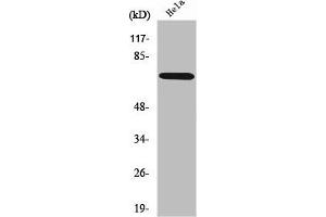 Western Blot analysis of HeLa cells using ABCF2 Polyclonal Antibody (ABCF2 Antikörper  (Internal Region))