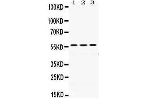 Western Blotting (WB) image for anti-Protein Disulfide Isomerase Family A, Member 3 (PDIA3) (AA 471-505), (C-Term) antibody (ABIN3043898) (PDIA3 Antikörper  (C-Term))