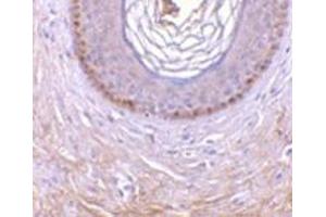 Immunohistochemistry of XEDAR in human skin tissue with this product at 10 μg/ml. (Ectodysplasin A2 Receptor Antikörper)