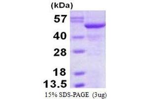 Image no. 1 for Nucleotide Exchange Factor SIL1 (SIL1) protein (His tag) (ABIN6386974) (SIL1 Protein (His tag))
