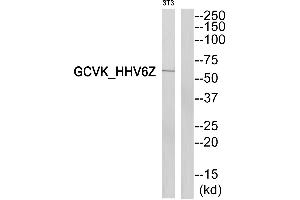 Western blot analysis of extracts from 3T3cells, using GCVK_HHV6Z antibody. (GCVK_HHV6Z Antikörper)