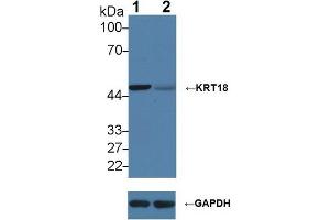 Western blot analysis of (1) Wild-type HeLa cell lysate, and (2) KRT18 knockout HeLa cell lysate, using Rabbit Anti-Human KRT18 Antibody (2 µg/ml) and HRP-conjugated Goat Anti-Mouse antibody ( (Cytokeratin 18 Antikörper  (AA 238-396))
