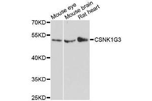Western blot analysis of extracts of various cell lines, using CSNK1G3 antibody. (CSNK1G3 Antikörper  (AA 304-423))