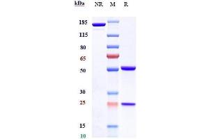 Anti-FOLR1 / FRA Reference Antibody (farletuzumab) on SDS-PAGE under reducing (R) condition.
