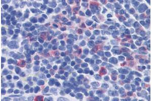 Mouse Spleen: Formalin-Fixed, Paraffin-Embedded (FFPE) (IL-17 Antikörper)
