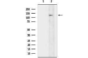 anti-Zinc Finger Protein 687 (ZNF687) antibody
