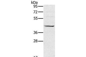 Western Blot analysis of Raji cell using MVK Polyclonal Antibody at dilution of 1:550 (MVK Antikörper)
