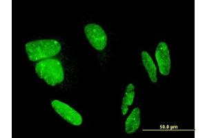 Immunofluorescence of monoclonal antibody to FLJ23834 on HeLa cell. (CDHR3 Antikörper  (AA 776-885))
