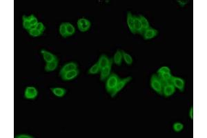Immunofluorescent analysis of HepG2 cells using ABIN7174147 at dilution of 1:100 and Alexa Fluor 488-congugated AffiniPure Goat Anti-Rabbit IgG(H+L) (ZRSR2 Antikörper  (AA 191-372))