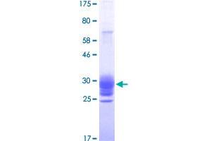 Image no. 1 for Tumor Necrosis Factor (Ligand) Superfamily, Member 15 (TNFSF15) (AA 72-251) protein (His-DYKDDDDK-Strep II Tag) (ABIN1323235) (TNFSF15 Protein (AA 72-251) (His-DYKDDDDK-Strep II Tag))