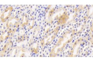 Detection of CTR in Mouse Kidney Tissue using Polyclonal Antibody to Calcitonin Receptor (CTR) (Calcitonin Receptor Antikörper  (AA 42-170))