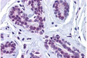 Human Breast: Formalin-Fixed, Paraffin-Embedded (FFPE) (Retinoblastoma Binding Protein 8 Antikörper  (Internal Region))
