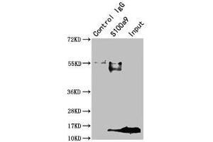 Immunoprecipitating S100a9 in Mouse spleen tissue Lane 1: Rabbit control IgG instead of ABIN7177798 in Mouse spleen tissue. (S1A9 (AA 2-113) Antikörper)