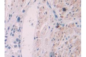 Immunohistochemistry (IHC) image for anti-Granzyme H (Cathepsin G-Like 2, Protein H-CCPX) (GZMH) (AA 19-246) antibody (ABIN1868308)