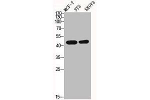 Western Blot analysis of MCF7 NIH-3T3 SKOV3 cells using ICAD Polyclonal Antibody (DFFA Antikörper  (Internal Region))