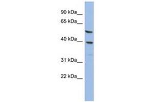 Image no. 1 for anti-Oleoyl-ACP Hydrolase (OLAH) (AA 35-84) antibody (ABIN6744030) (OLAH Antikörper  (AA 35-84))
