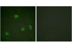 Immunofluorescence analysis of HeLa cells, using Histone H3 (Acetyl-Lys23) Antibody. (Histone 3 Antikörper  (H3K23ac))