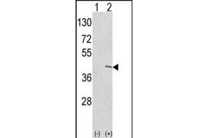 Western blot analysis of EKI1 (arrow) using rabbit polyclonal hEKI1-C3 (ABIN391086 and ABIN2841227). (Ethanolamine Kinase 1 Antikörper  (N-Term))