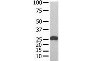 GST Tag antibody used in western blot with recombinant protein (GST-Tag Antikörper)