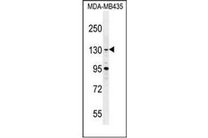 Western blot analysis of GLTSCR1 Antibody (Center) in MDA-MB435 cell line lysates (35ug/lane). (Gltscr1 Antikörper  (Middle Region))