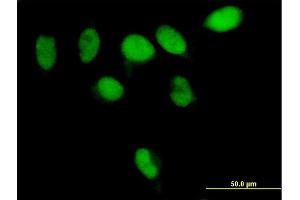 Immunofluorescence of purified MaxPab antibody to PARG on HeLa cell. (PARG Antikörper  (AA 1-976))