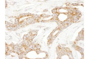 anti-CAP-GLY Domain Containing Linker Protein 1 (CLIP1) (AA 1388-1438) antibody