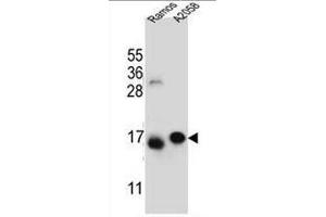 EIF5AL1 Antibody (C-term) western blot analysis in Ramos,A2058 cell line lysates (35µg/lane). (EIF5AL1 Antikörper  (C-Term))