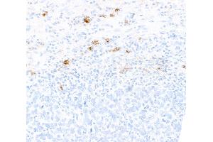 Immunohistochemistry (IHC) image for anti-CD80 (CD80) (AA 35-246) antibody (ABIN7449415) (Rekombinanter CD80 Antikörper  (AA 35-246))