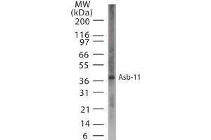 Image no. 1 for anti-Ankyrin Repeat and SOCS Box-Containing 11 (ASB11) (AA 40-51) antibody (ABIN233024) (ASB11 Antikörper  (AA 40-51))