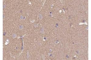 Immunohistochemistry analysis of CD57 antibody in paraffin-embedded human brain tissue. (CD57 Antikörper  (N-Term))
