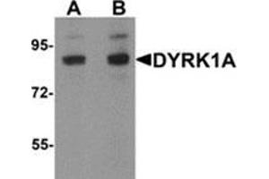 Western blot analysis of DYRK1A in HeLa cell lysate with DYRK1A antibody at (A) 1 and (B) 2 μg/ml. (DYRK1A Antikörper  (C-Term))