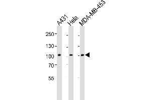 Western blot analysis of lysates from A431, Hela, MDA-MB-453 cell line (from left to right), using EPHB1 Antibody  (ABIN391917 and ABIN2841727). (EPH Receptor B1 Antikörper  (C-Term))