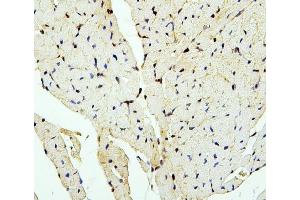 IHC analysis of PTBP2 using anti-PTBP2 antibody (ABIN7599452).