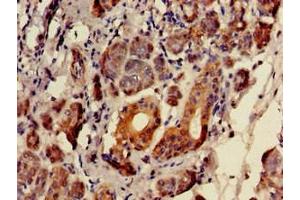 Immunohistochemistry of paraffin-embedded human salivary gland tissue using ABIN7152346 at dilution of 1:100 (SULF2 Antikörper  (AA 463-660))